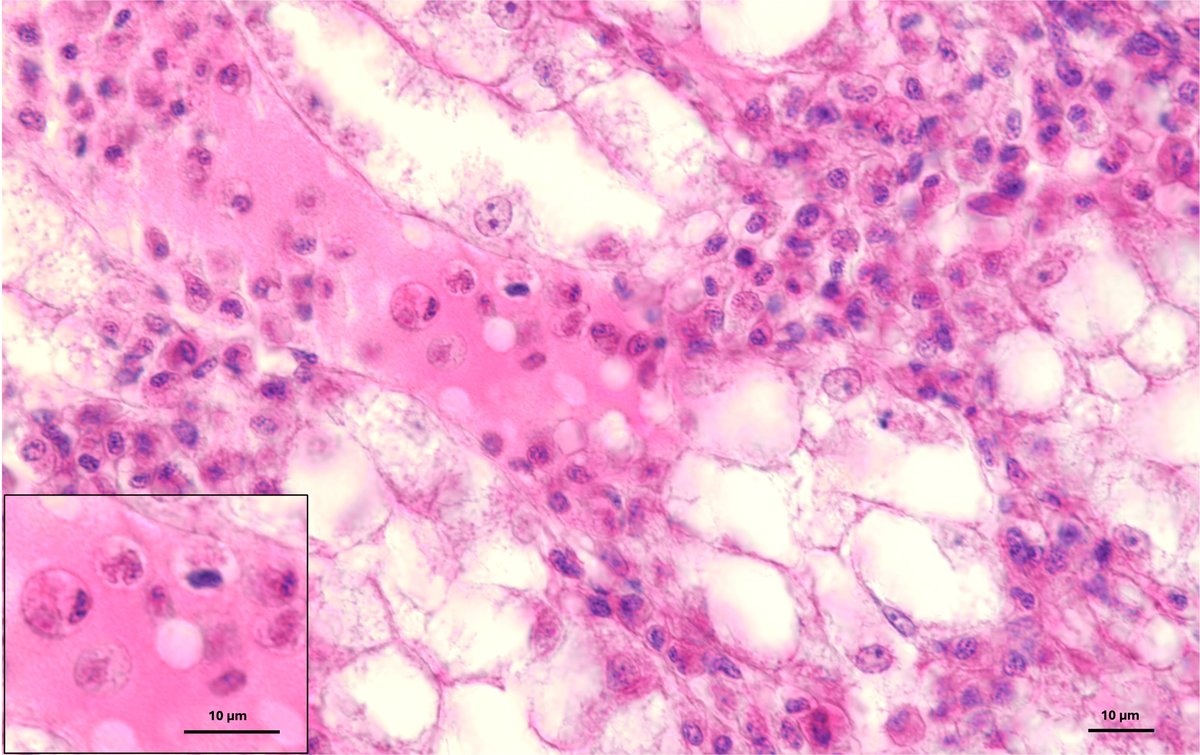 N. 18 - Hemocyte traffic is getting messy