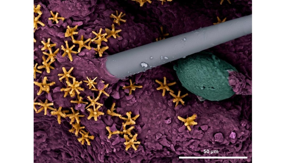 N. 21 - The sponge cosmos: oocyte in a constellation of spicules