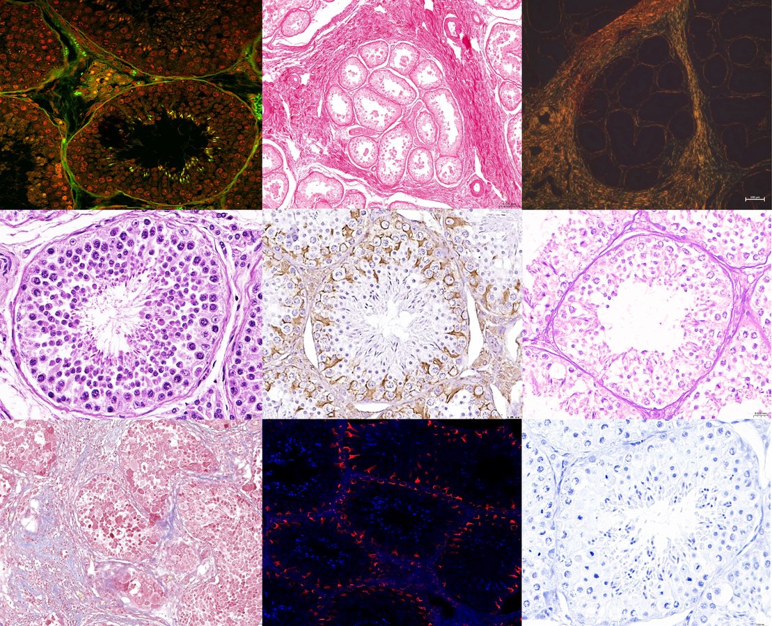 N. 2 - Pop Histology: omaggio a Marilyn