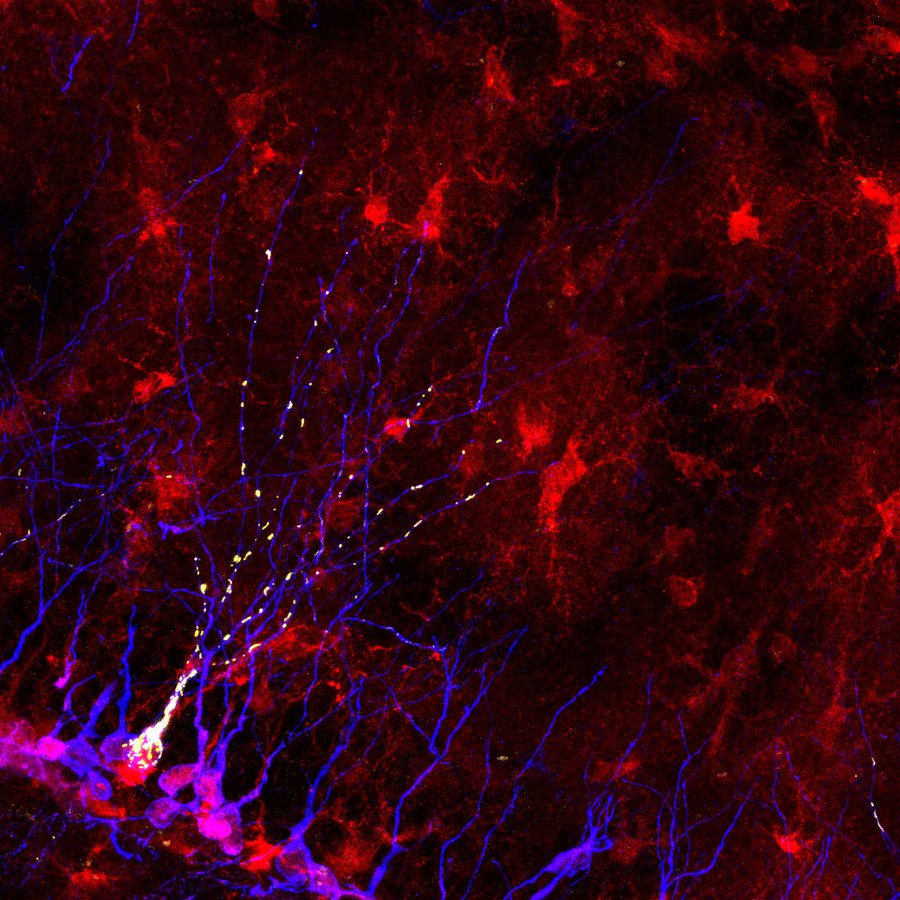 N. 15 - Costellazioni mitocondriali: l'energia che accende i nuovi neuroni