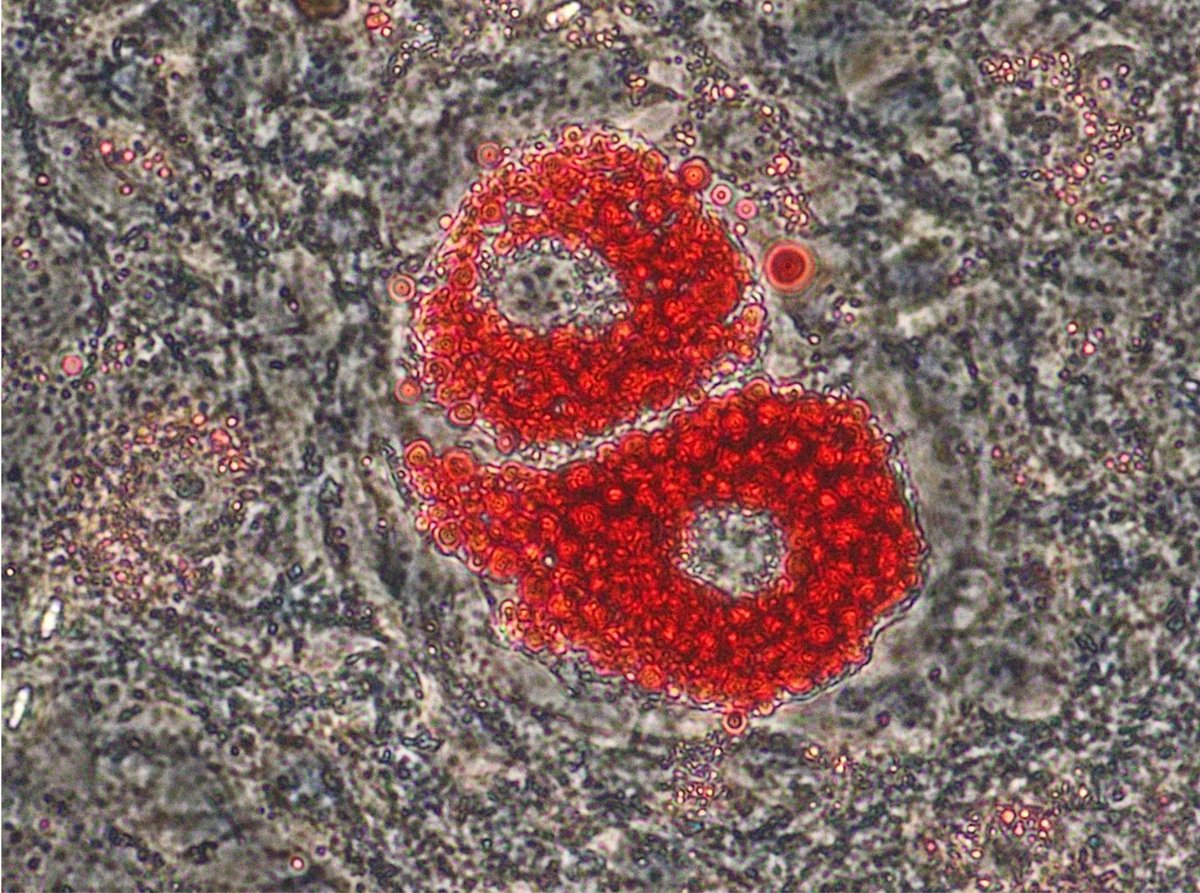 N. 20 - Cellular Couture: Adipocytes in Valentino Red