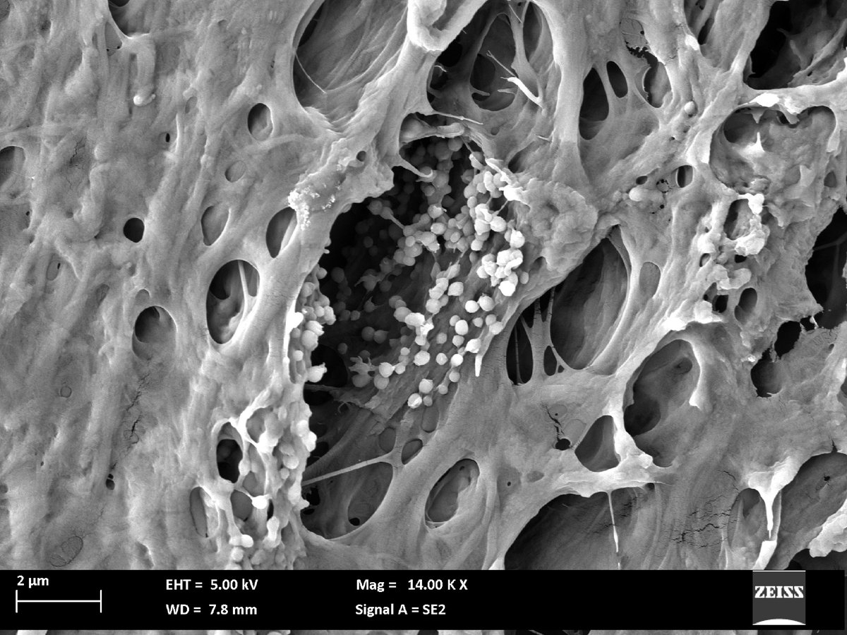 N. 17 - Let It Grow: The Secret Life of Vesicles
